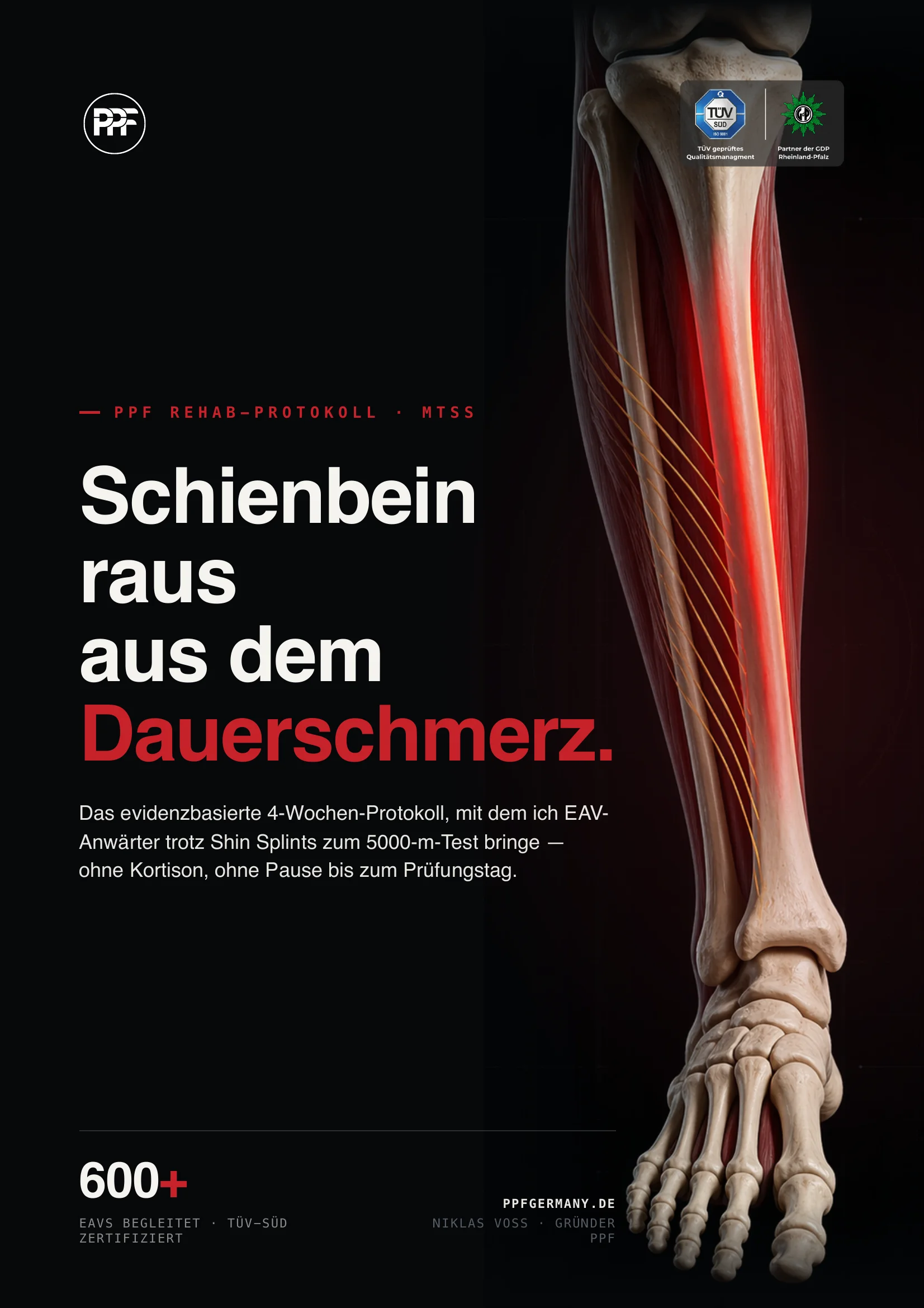 Schienbein raus aus dem Dauerschmerz: Das MTSS Rehab-Protokoll